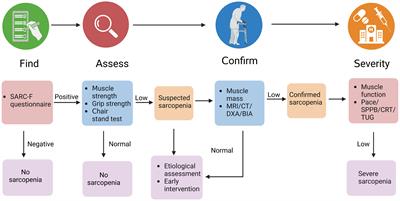 Pathogenesis and comprehensive treatment strategies of sarcopenia in elderly patients with type 2 diabetes mellitus